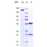 SDS-PAGE - Anti-ILT-4 Antibody [JTX-8064] - Low endotoxin, Azide free (A324107) - Antibodies.com