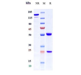 SDS-PAGE - Anti-Integrin beta 1 Antibody [OS2966] - Low endotoxin, Azide free (A324111) - Antibodies.com