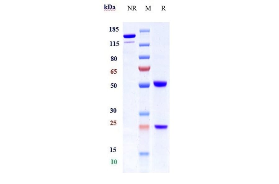 SDS-PAGE - Anti-Integrin beta 1 Antibody [OS2966] - Low endotoxin, Azide free (A324111) - Antibodies.com