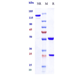 SDS-PAGE - Anti-IP10 Antibody [NI-0801] - Low endotoxin, Azide free (A324116) - Antibodies.com