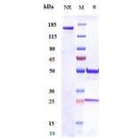 SDS-PAGE - Anti-ITGA11 Antibody [Research Grade Biosimilar] - Low endotoxin, Azide free (A324117) - Antibodies.com