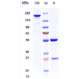SDS-PAGE - Anti-K Cadherin/CDH6 Antibody [HKT288] - Low endotoxin, Azide free (A324119) - Antibodies.com
