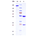 SDS-PAGE - Anti-Kallikrein 2/KLK2 Antibody [JNJ-69086420] - Low endotoxin, Azide free (A324120) - Antibodies.com