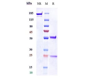 SDS-PAGE - Anti-Kallikrein 5 Antibody [Research Grade Biosimilar] - Low endotoxin, Azide free (A324121) - Antibodies.com