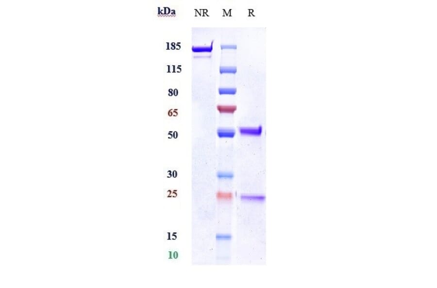 SDS-PAGE - Anti-Kallikrein 5 Antibody [Research Grade Biosimilar] - Low endotoxin, Azide free (A324121) - Antibodies.com