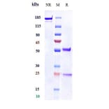SDS-PAGE - Anti-Kallikrein 5 Antibody [Research Grade Biosimilar] - Low endotoxin, Azide free (A324121) - Antibodies.com