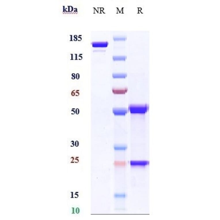 SDS-PAGE - Anti-KLB Antibody [NGM313] - Low endotoxin, Azide free (A324123) - Antibodies.com