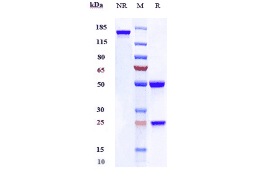 SDS-PAGE - Anti-KLB Antibody [RG7992] - Low endotoxin, Azide free (A324124) - Antibodies.com
