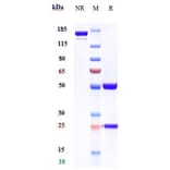 SDS-PAGE - Anti-MERTK Antibody [RGX-019] - Low endotoxin, Azide free (A324142) - Antibodies.com