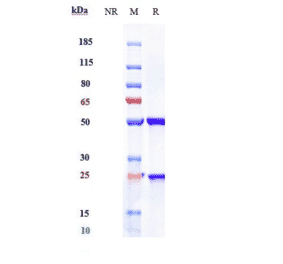 SDS-PAGE - Anti-Mesothelin Antibody [Research Grade Biosimilar] - Low endotoxin, Azide free (A324143) - Antibodies.com