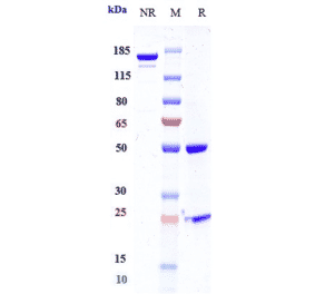 SDS-PAGE - Anti-Mesothelin Antibody [BMS-986148] - Low endotoxin, Azide free (A324144) - Antibodies.com