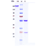 SDS-PAGE - Anti-Met (c-Met) Antibody [Research Grade Biosimilar] - Low endotoxin, Azide free (A324147) - Antibodies.com