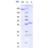 SDS-PAGE - Anti-MMP9 Antibody [Research Grade Biosimilar] - Low endotoxin, Azide free (A324151) - Antibodies.com