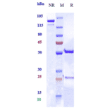 SDS-PAGE - Anti-MRC2/ENDO180 Antibody [Research Grade Biosimilar] - Low endotoxin, Azide free (A324155) - Antibodies.com