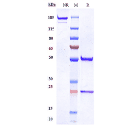 SDS-PAGE - Anti-MUSK Antibody [Research Grade Biosimilar] - Low endotoxin, Azide free (A324159) - Antibodies.com