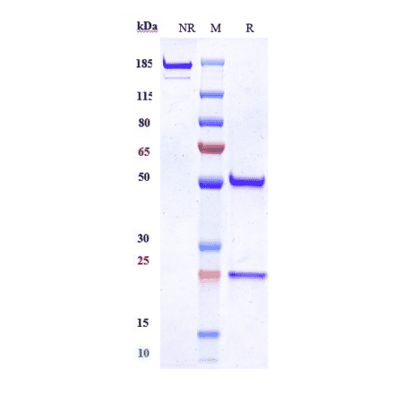 SDS-PAGE - Anti-MUSK Antibody [Research Grade Biosimilar] - Low endotoxin, Azide free (A324159) - Antibodies.com