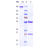 SDS-PAGE - Anti-MUSK Antibody [Research Grade Biosimilar] - Low endotoxin, Azide free (A324159) - Antibodies.com