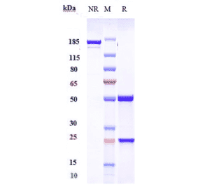 SDS-PAGE - Anti-NGF Antibody [MEDI-578] - Low endotoxin, Azide free (A324162) - Antibodies.com