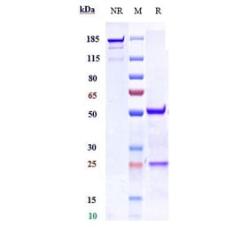 SDS-PAGE - Anti-Nogo Receptor Antibody [Research Grade Biosimilar] - Low endotoxin, Azide free (A324164) - Antibodies.com