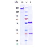 SDS-PAGE - Anti-Nogo Receptor Antibody [Research Grade Biosimilar] - Low endotoxin, Azide free (A324164) - Antibodies.com