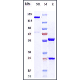 SDS-PAGE - Anti-OxLDL Antibody [Research Grade Biosimilar] - Low endotoxin, Azide free (A324170) - Antibodies.com