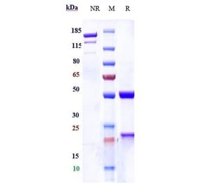 SDS-PAGE - Anti-P Cadherin Antibody [PF-03732010] - Low endotoxin, Azide free (A324171) - Antibodies.com