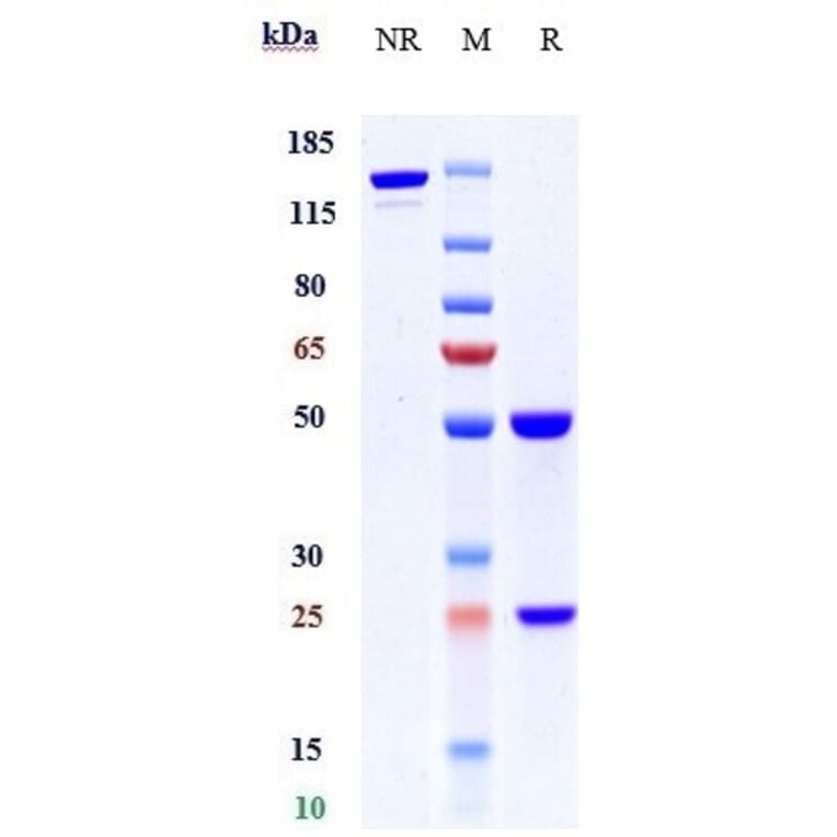 SDS-PAGE - Anti-PACAP-38 Antibody [Research Grade Biosimilar] - Low endotoxin, Azide free (A324172) - Antibodies.com