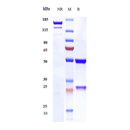 SDS-PAGE - Anti-PAR2 Antibody [PAR650097] - Low endotoxin, Azide free (A324176) - Antibodies.com