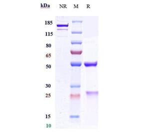 SDS-PAGE - Anti-PCSK9 Antibody [Research Grade Biosimilar] - Low endotoxin, Azide free (A324178) - Antibodies.com