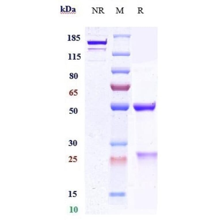 Recombinant Anti-PCSK9 Antibody [Research Grade Biosimilar] (A324178)