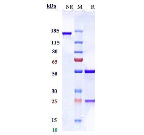 SDS-PAGE - Anti-PCSK9 Antibody [Research Grade Biosimilar] - Low endotoxin, Azide free (A324179) - Antibodies.com