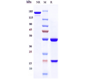 SDS-PAGE - Anti-PCSK9 Antibody [Research Grade Biosimilar] - Low endotoxin, Azide free (A324180) - Antibodies.com