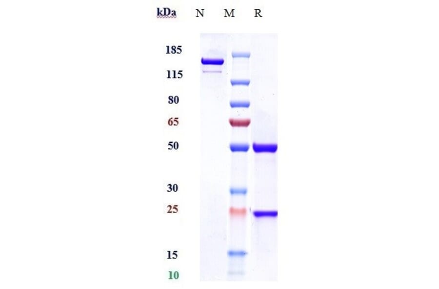 SDS-PAGE - Anti-PDGFC Antibody [Research Grade Biosimilar] - Low endotoxin, Azide free (A324184) - Antibodies.com