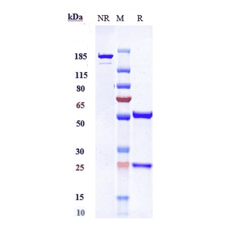 SDS-PAGE - Anti-PDGFR beta Antibody [IMC-2C5] - Low endotoxin, Azide free (A324185) - Antibodies.com