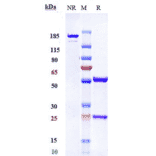 SDS-PAGE - Anti-PDGFR beta Antibody [IMC-2C5] - Low endotoxin, Azide free (A324185) - Antibodies.com