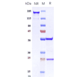 SDS-PAGE - Anti-PF4 Antibody [Research Grade Biosimilar] - Low endotoxin, Azide free (A324187) - Antibodies.com