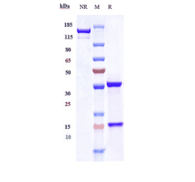 SDS-PAGE - Anti-Plxdc2 Antibody [Research Grade Biosimilar] - Low endotoxin, Azide free (A324192) - Antibodies.com