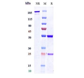 SDS-PAGE - Anti-Polyubiquitin-C Antibody [Research Grade Biosimilar] - Low endotoxin, Azide free (A324194) - Antibodies.com