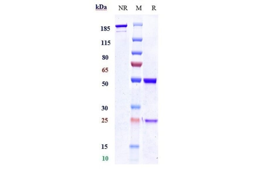 SDS-PAGE - Anti-Polyubiquitin-C Antibody [Research Grade Biosimilar] - Low endotoxin, Azide free (A324194) - Antibodies.com