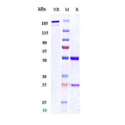 SDS-PAGE - Anti-Polyubiquitin-C Antibody [Research Grade Biosimilar] - Low endotoxin, Azide free (A324194) - Antibodies.com
