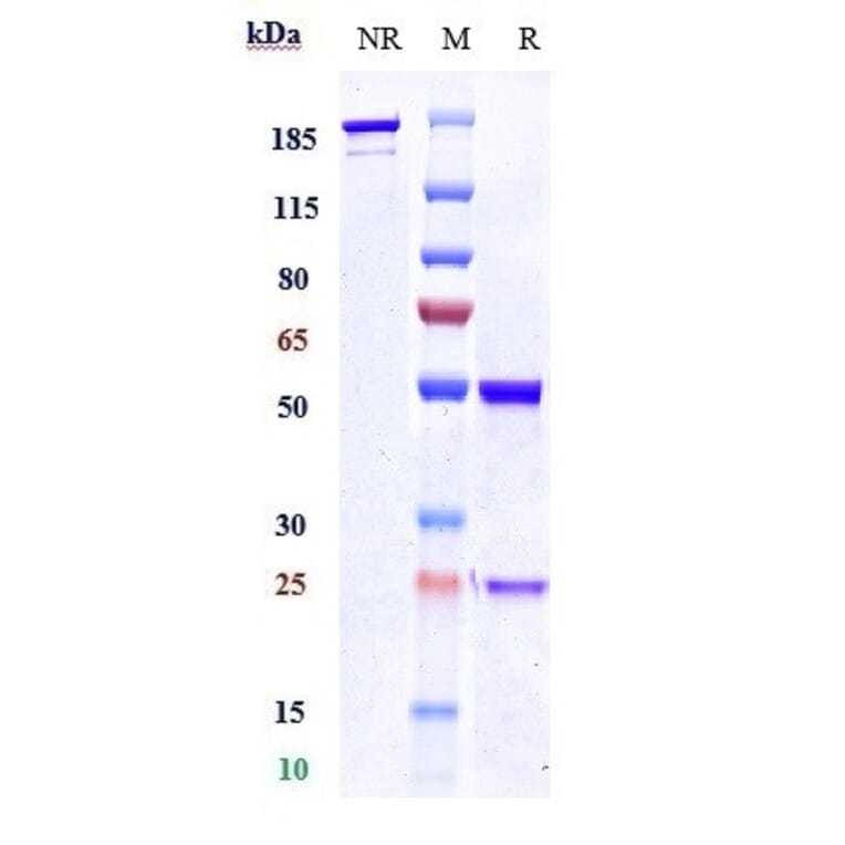 SDS-PAGE - Anti-Polyubiquitin-C Antibody [Research Grade Biosimilar] - Low endotoxin, Azide free (A324194) - Antibodies.com