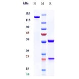 SDS-PAGE - Anti-PRAME Antibody [Research Grade Biosimilar] - Low endotoxin, Azide free (A324195) - Antibodies.com