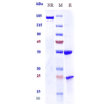 SDS-PAGE - Anti-Prolactin Receptor/PRL-R Antibody [Research Grade Biosimilar] - Low endotoxin, Azide free (A324196) - Antibodies.com
