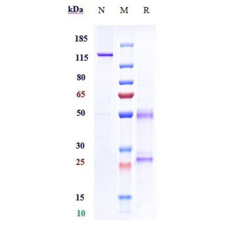 SDS-PAGE - Anti-PSCA Antibody [AGS-1C4D4] - Low endotoxin, Azide free (A324198) - Antibodies.com