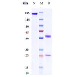 SDS-PAGE - Anti-PVRIG/CD112R Antibody [GSK4381562] - Low endotoxin, Azide free (A324200) - Antibodies.com