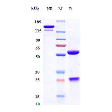 SDS-PAGE - Anti-RANTES Antibody [NI-0701] - Low endotoxin, Azide free (A324203) - Antibodies.com