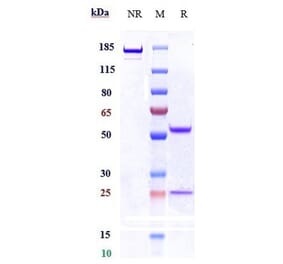 SDS-PAGE - Anti-Ret Antibody [Research Grade Biosimilar] - Low endotoxin, Azide free (A324205) - Antibodies.com
