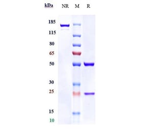 SDS-PAGE - Anti-RG1 Antibody [19G9] - Low endotoxin, Azide free (A324206) - Antibodies.com