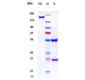 SDS-PAGE - Anti-Robo1 Antibody [Research Grade Biosimilar] - Low endotoxin, Azide free (A324208) - Antibodies.com