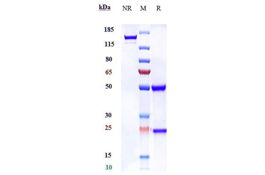 SDS-PAGE - Anti-Robo1 Antibody [Research Grade Biosimilar] - Low endotoxin, Azide free (A324208) - Antibodies.com
